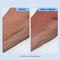 Dual Action Repair Cream